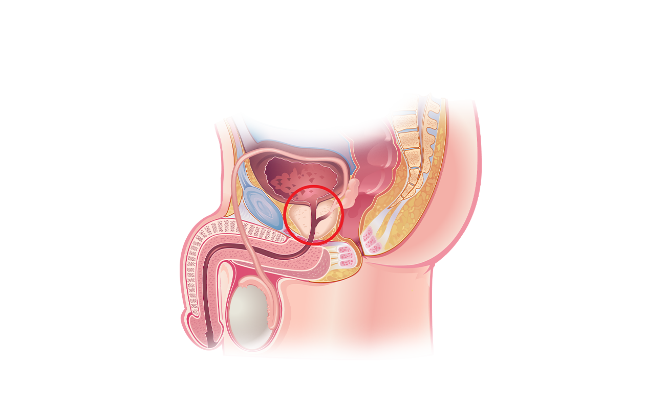 Image signifying prostate health