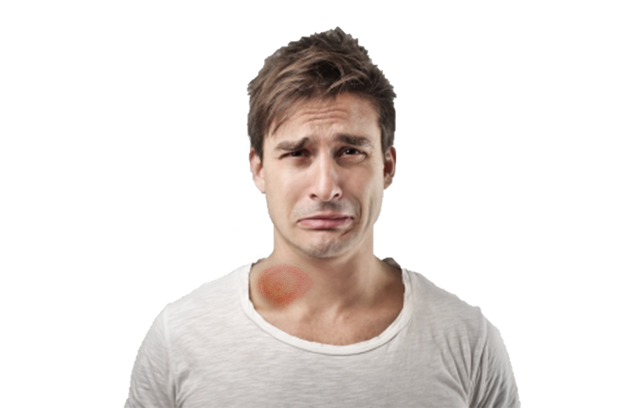 Image of distraught man crying with large rash on his neck from Lyme Disease.