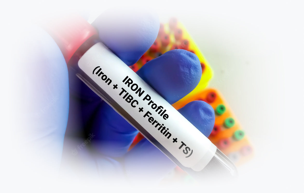 Image of test tube of blood for iron test