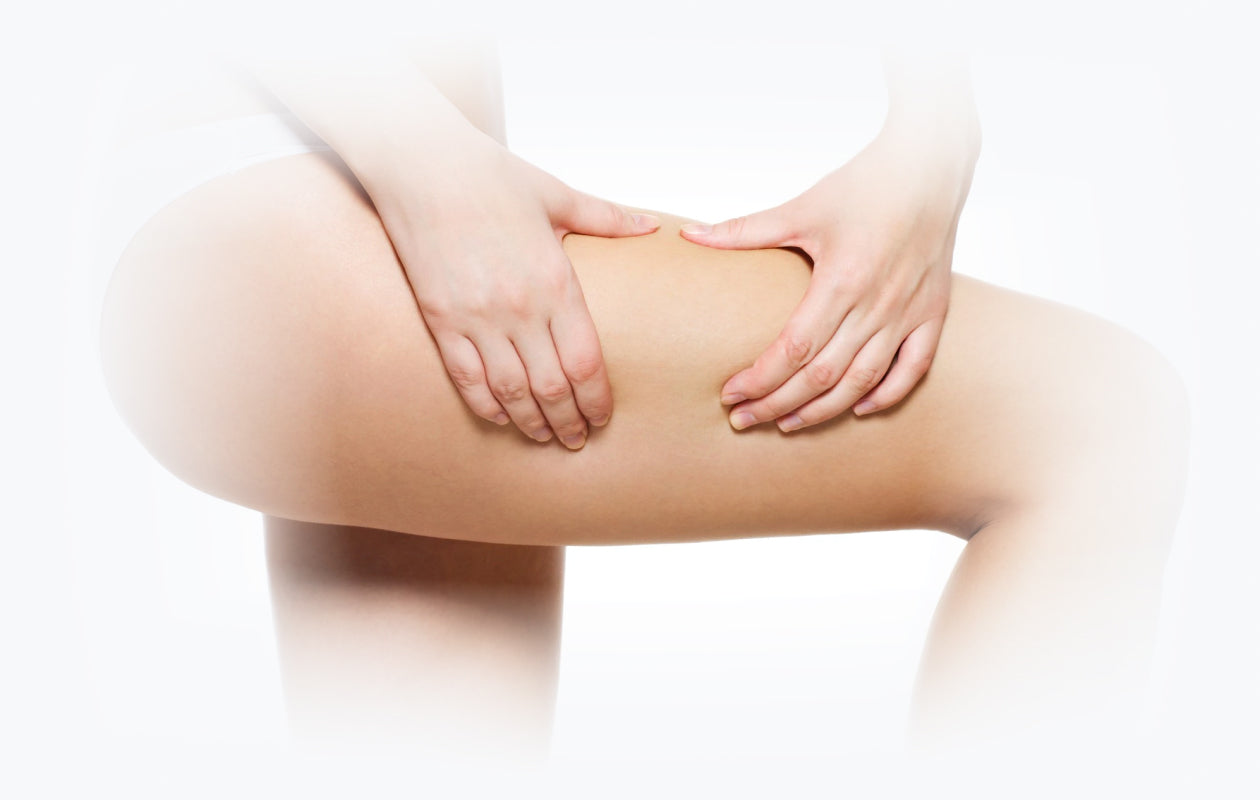 Photo of woman holding her leg where there is Cellulite