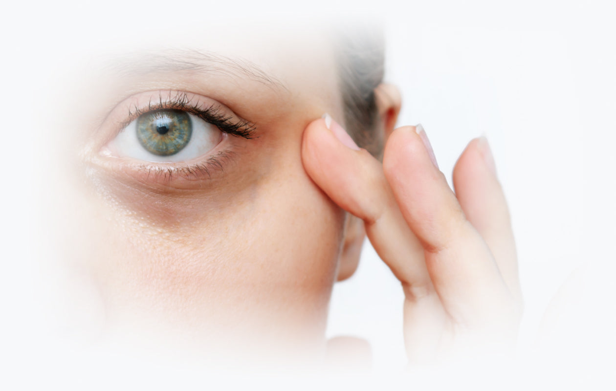 Image womans face with dark circles underneath her eyes