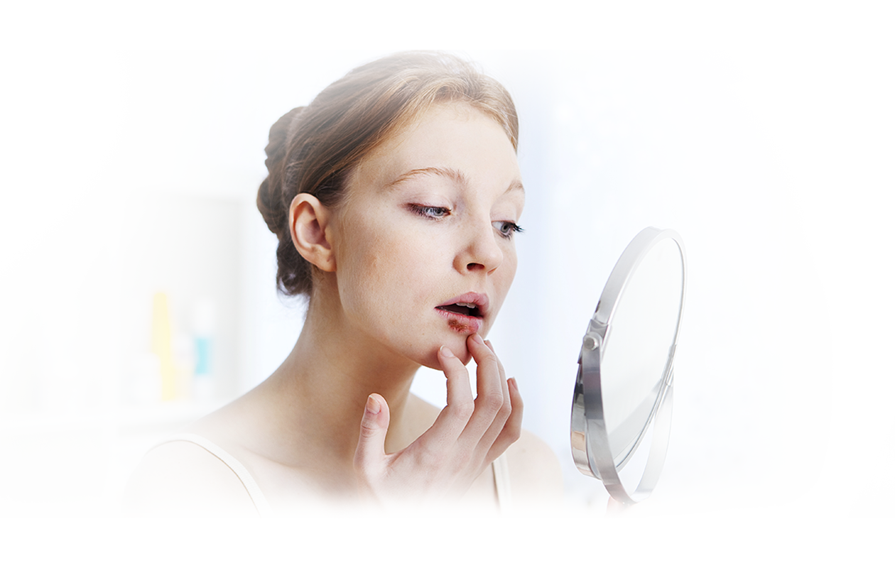 Image of woman looking into circular mirror examining her cold sore on lip.