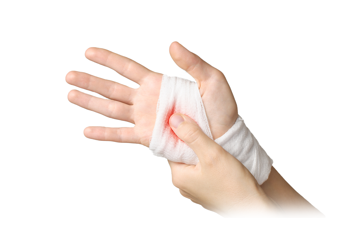 Image of bandaged hand.